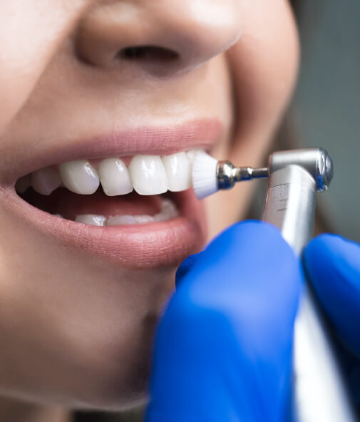 Closeup of patient receiving dental cleaning