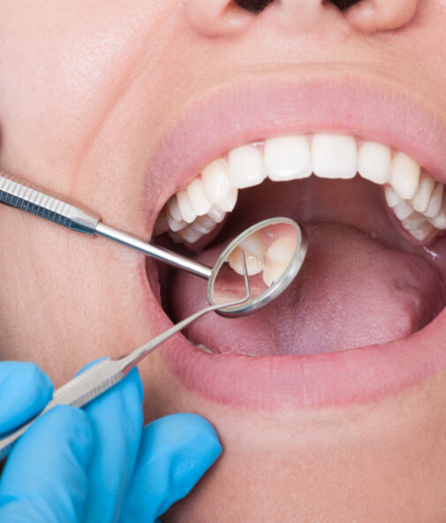 Closeup of patient receiving dental checkup