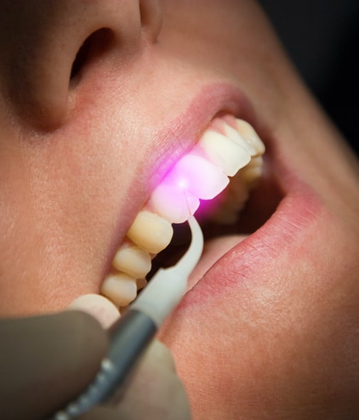 Patient receiving laser dentistry treatment