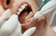Patient receiving laser gum disease therapy
